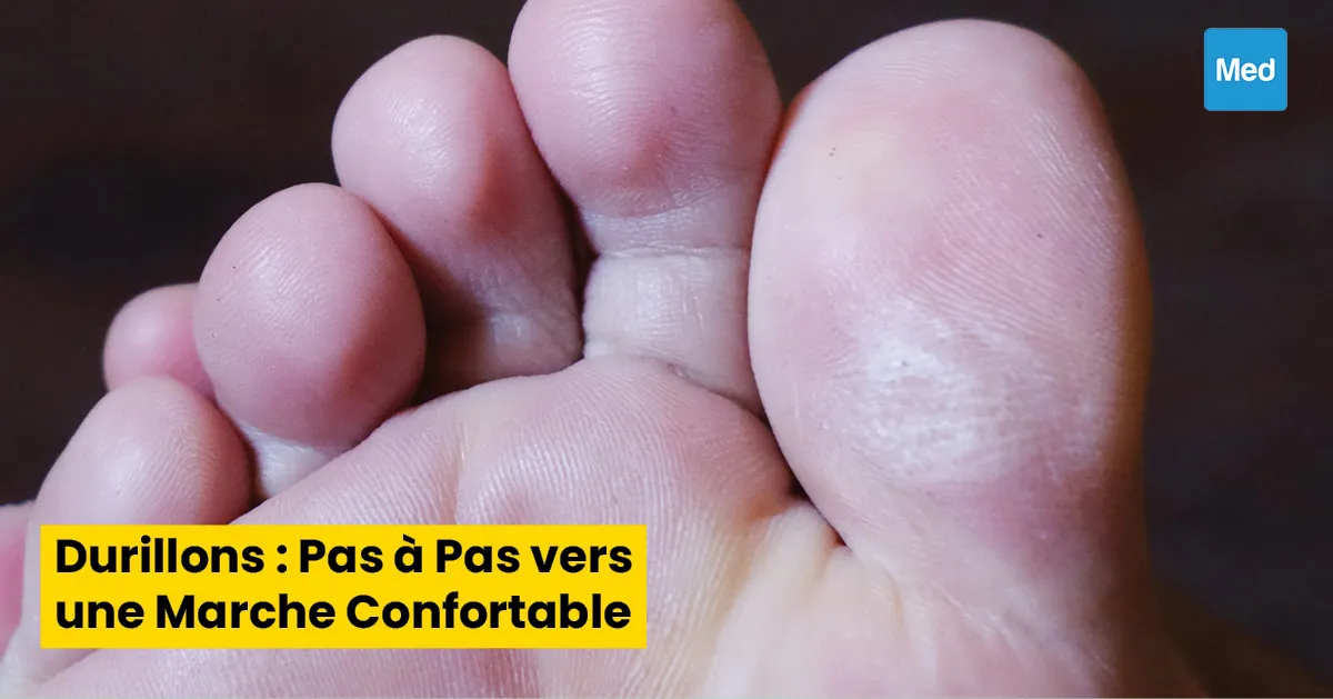 Durillons : Pas à Pas vers une Marche Confortable